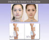 Ultrasonic Cavitation Slimming Machine